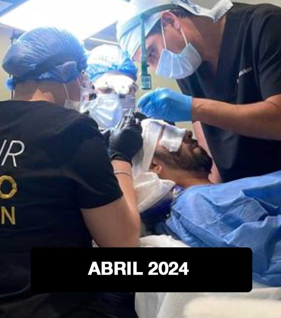 Hair Transplant Workshop ABRIL 2024